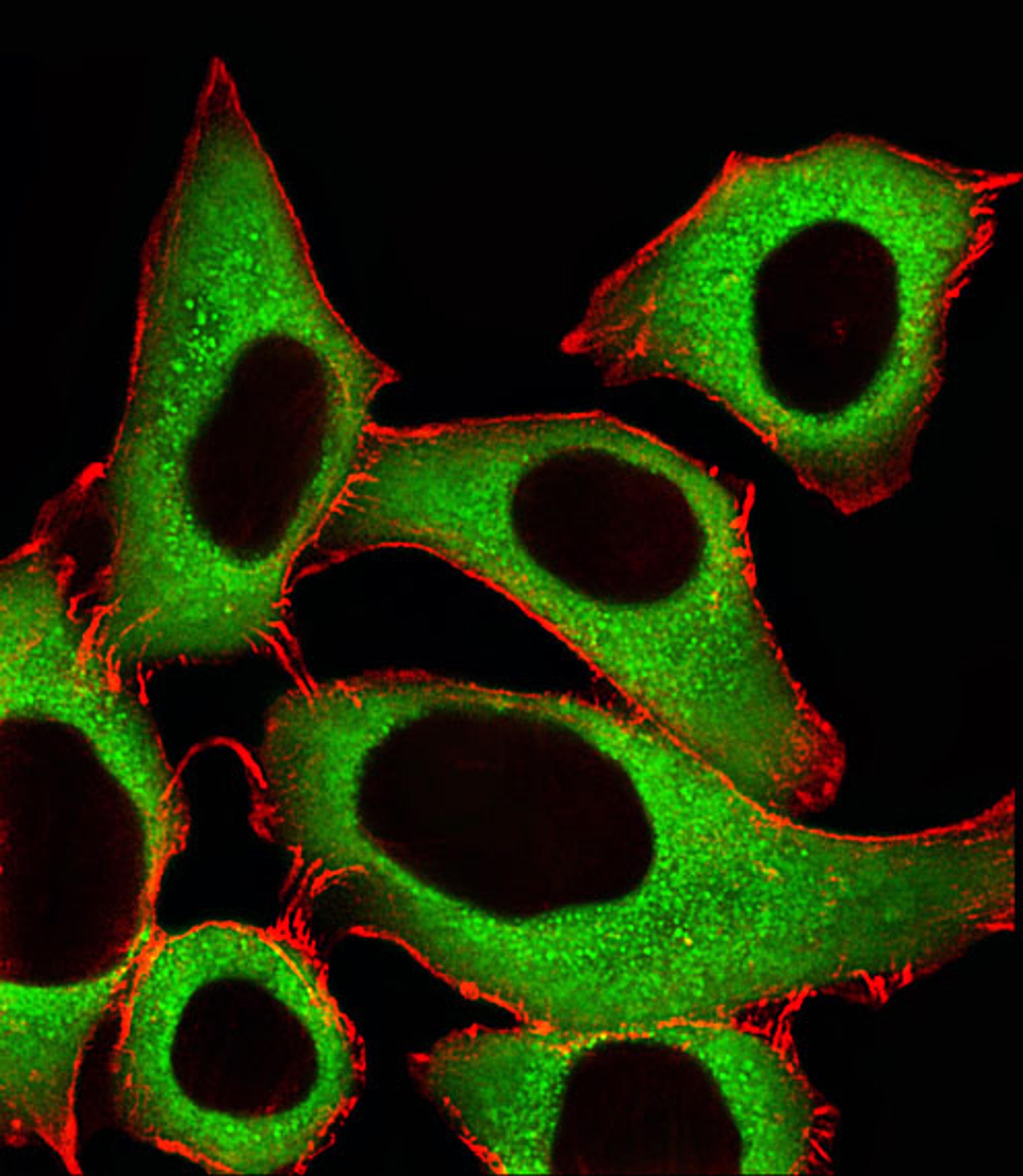 Fluorescent image of A549 cells stained with ALDH1A1 Antibody . AP20580c was diluted at 1:25 dilution. An Alexa Fluor 488-conjugated goat anti-rabbit lgG at 1:400 dilution was used as the secondary antibody (green). Cytoplasmic actin was counterstained wi