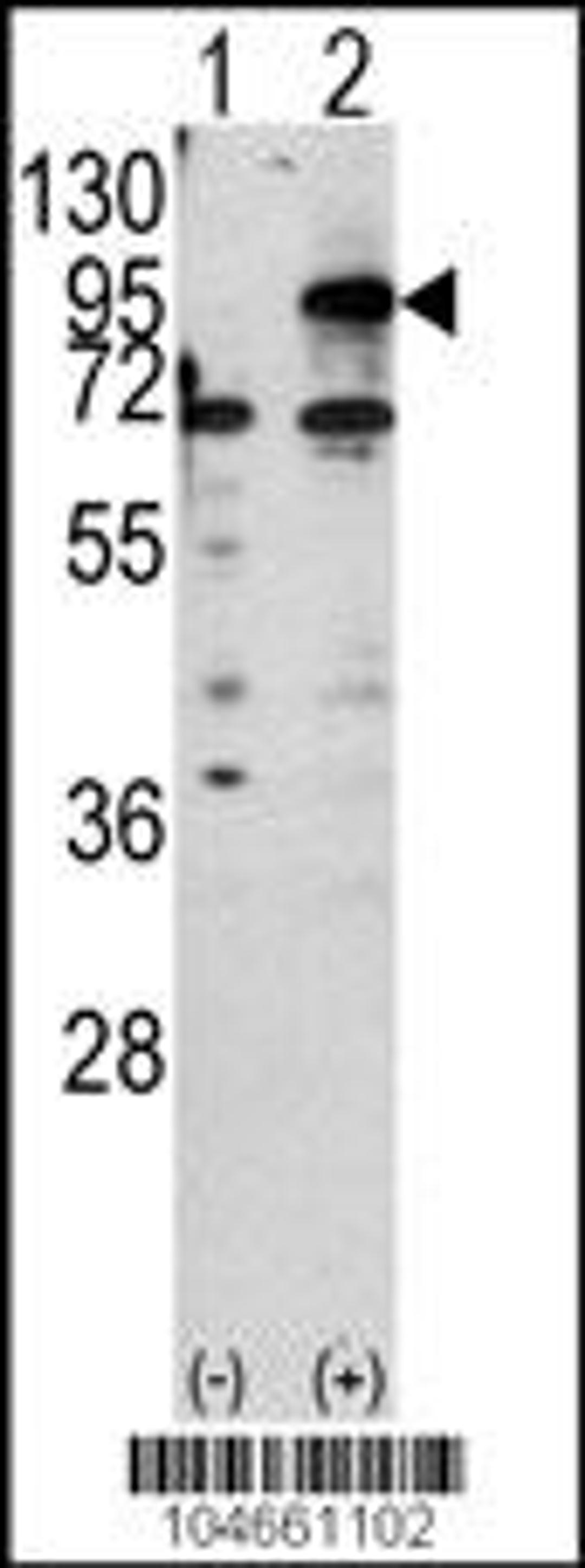 Western blot analysis of CPT1B using rabbit polyclonal CPT1B Antibody using 293 cell lysates (2 ug/lane) either nontransfected (Lane 1) or transiently transfected with the CPT1B gene (Lane 2).