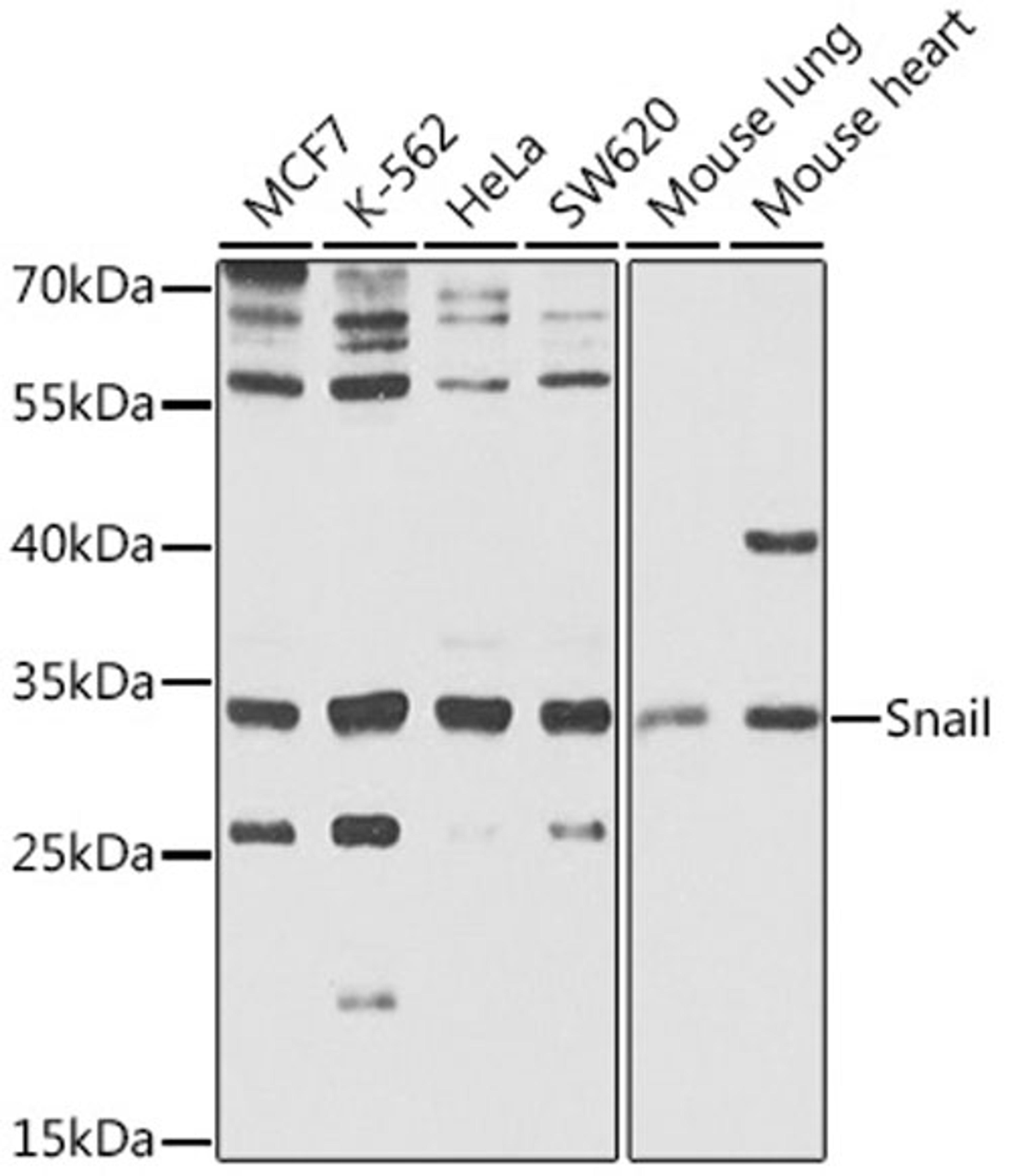 Western blot - Snail antibody (A5544)