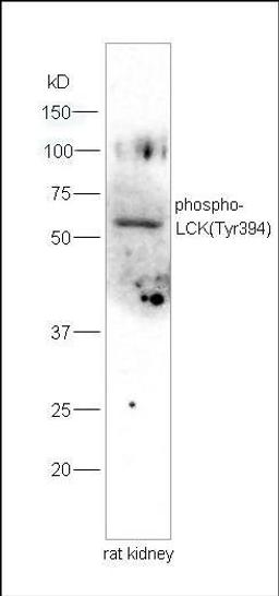 Western blot analysis of rat kidney lysates using LCK (phospho-Tyr394) antibody.