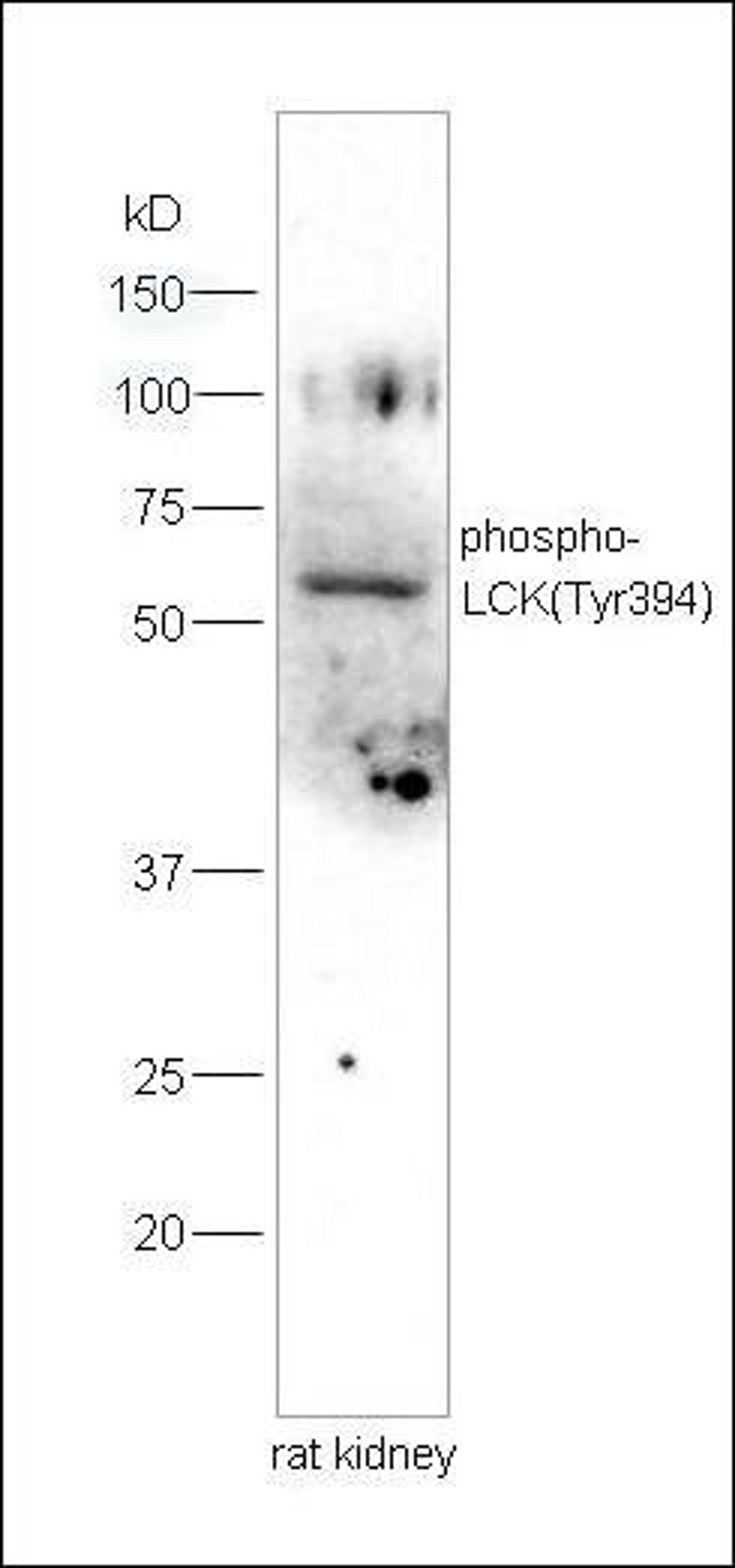 Western blot analysis of rat kidney lysates using LCK (phospho-Tyr394) antibody.