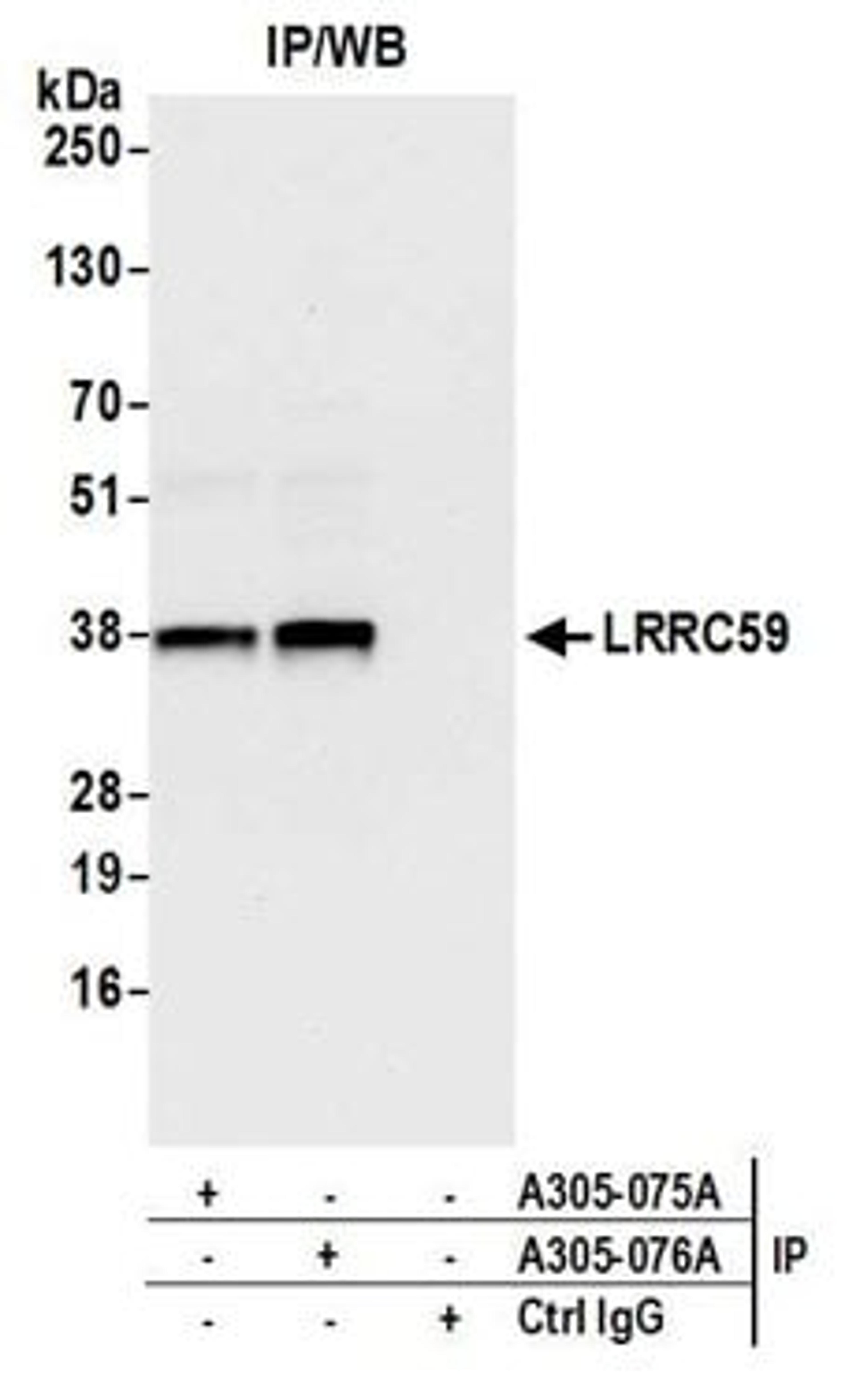 Detection of human LRRC59 by western blot of immunoprecipitates.