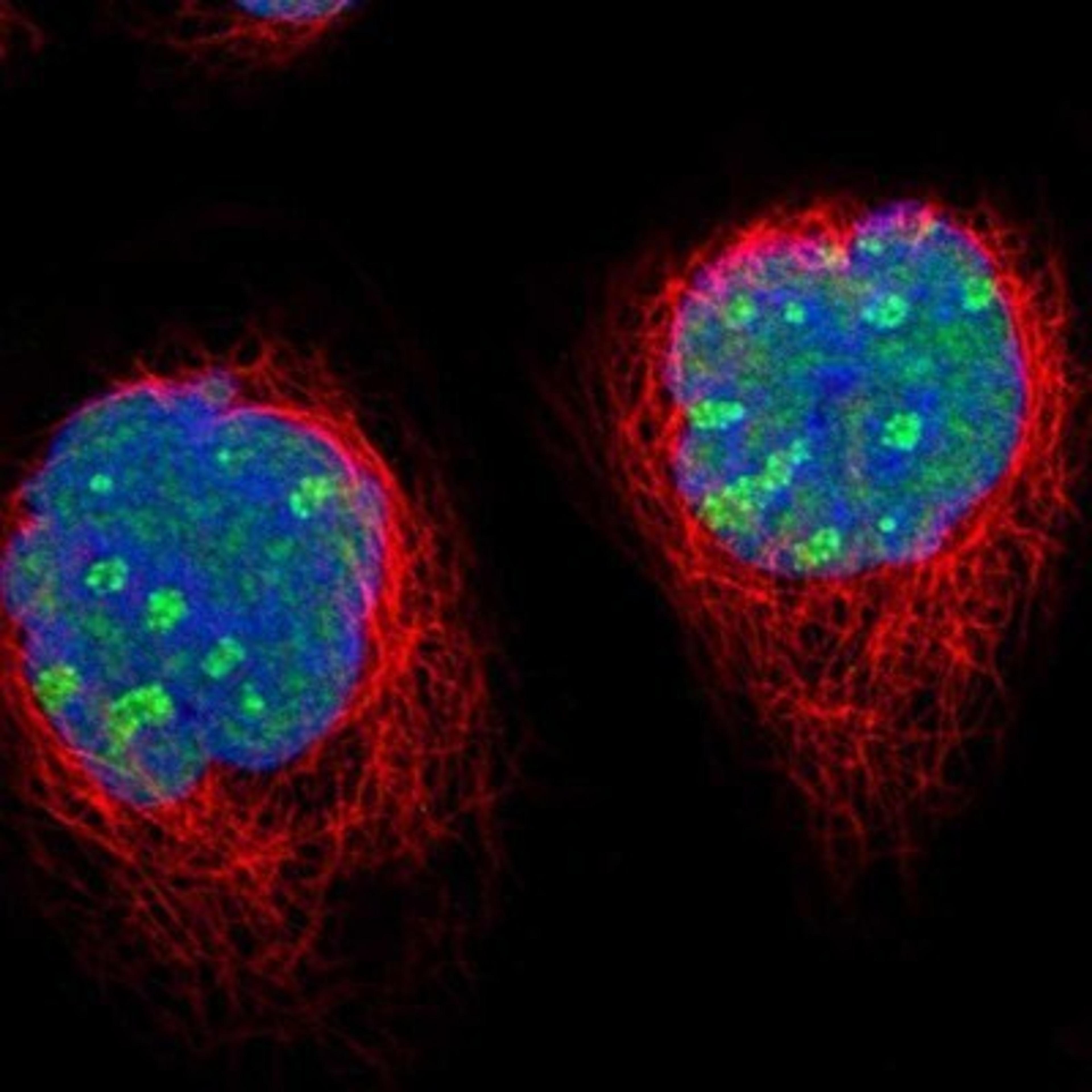 Immunocytochemistry/Immunofluorescence: Topoisomerase I Antibody [NBP1-90365] - Staining of human cell line A-431 shows positivity in nucleus & nucleoli.