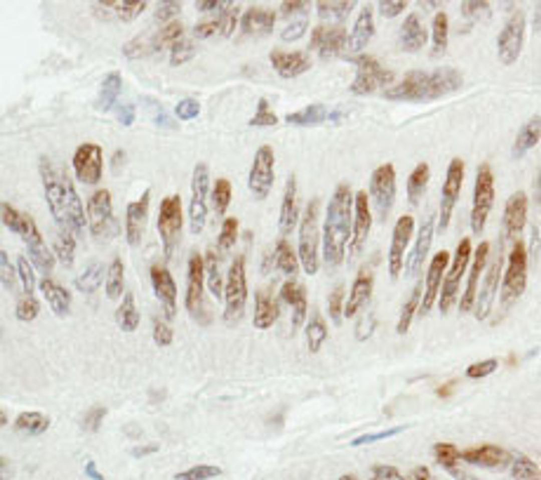 Detection of human ZBTB7/FBI-1 by immunohistochemistry.