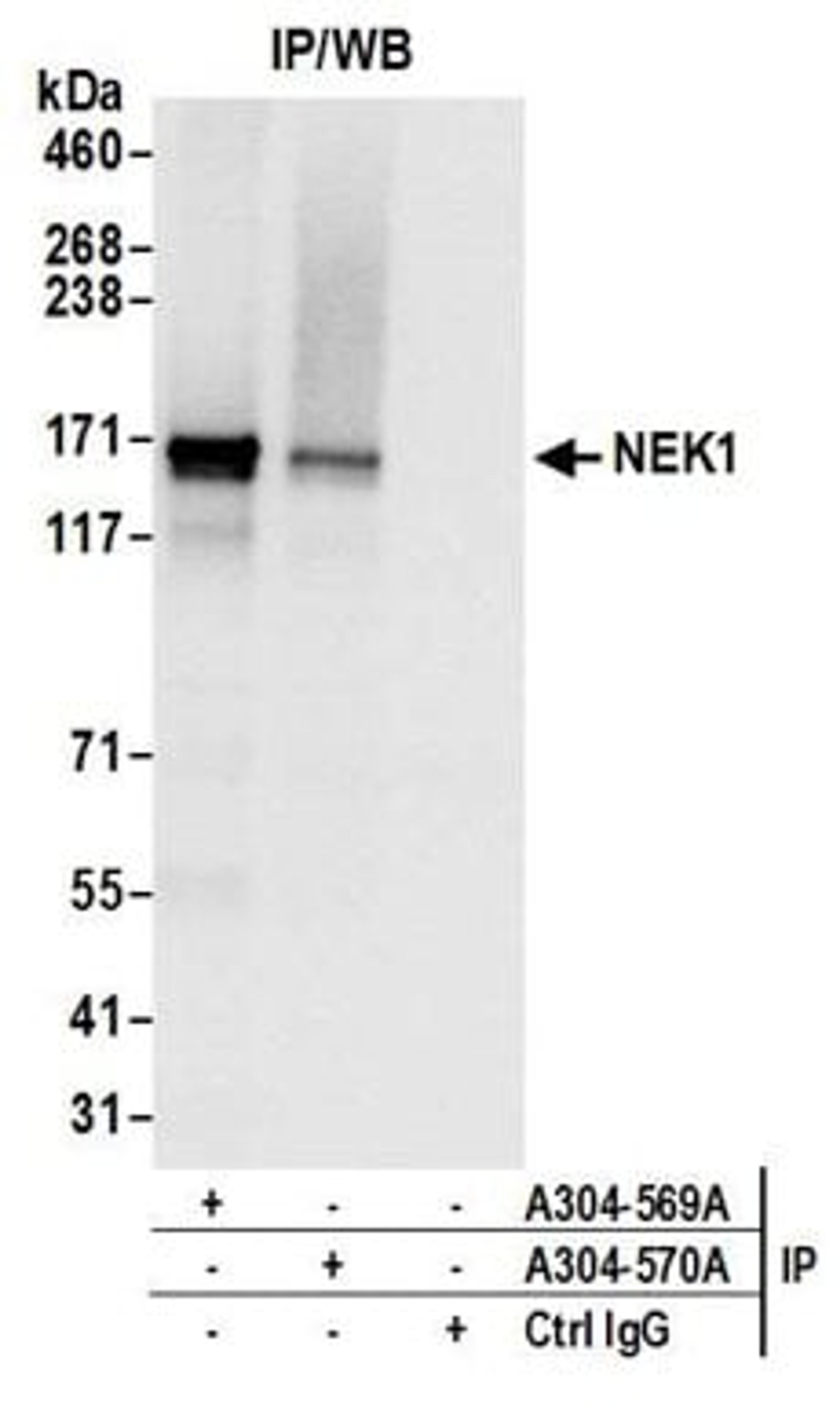 Detection of human NEK1 by western blot of immunoprecipitates.