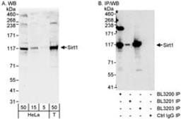 Detection of human Sirt1 by western blot and immunoprecipitation.