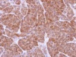 Immunohistochemistry: GSTT1 Antibody [NBP1-32733] - analysis of paraffin-embedded SW480 xenograft, using GSTT1 antibody at 1:500 dilution.