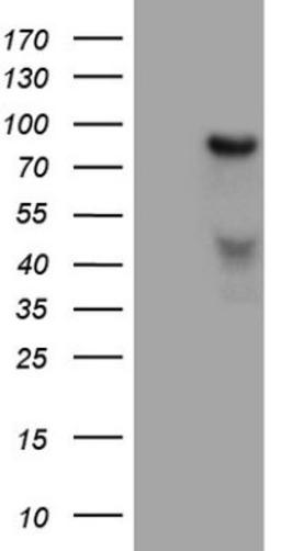 Western Blot: HGF Antibody (1D2) [NBP2-45972] - Analysis of HEK293T cells were transfected with the pCMV6-ENTRY control (Left lane) or pCMV6-ENTRY HGF.