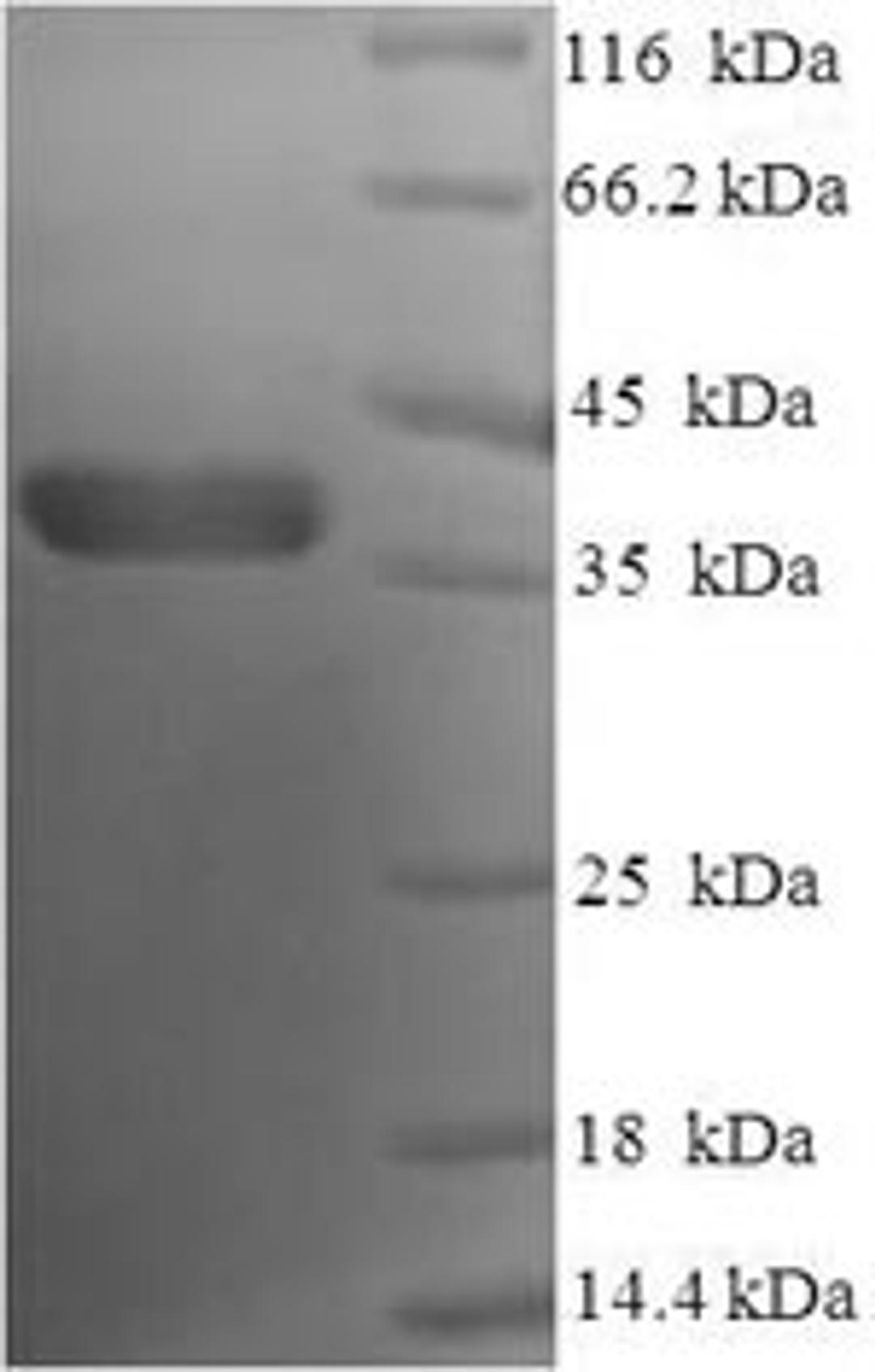 (Tris-Glycine gel) Discontinuous SDS-PAGE (reduced) with 5% enrichment gel and 15% separation gel.
