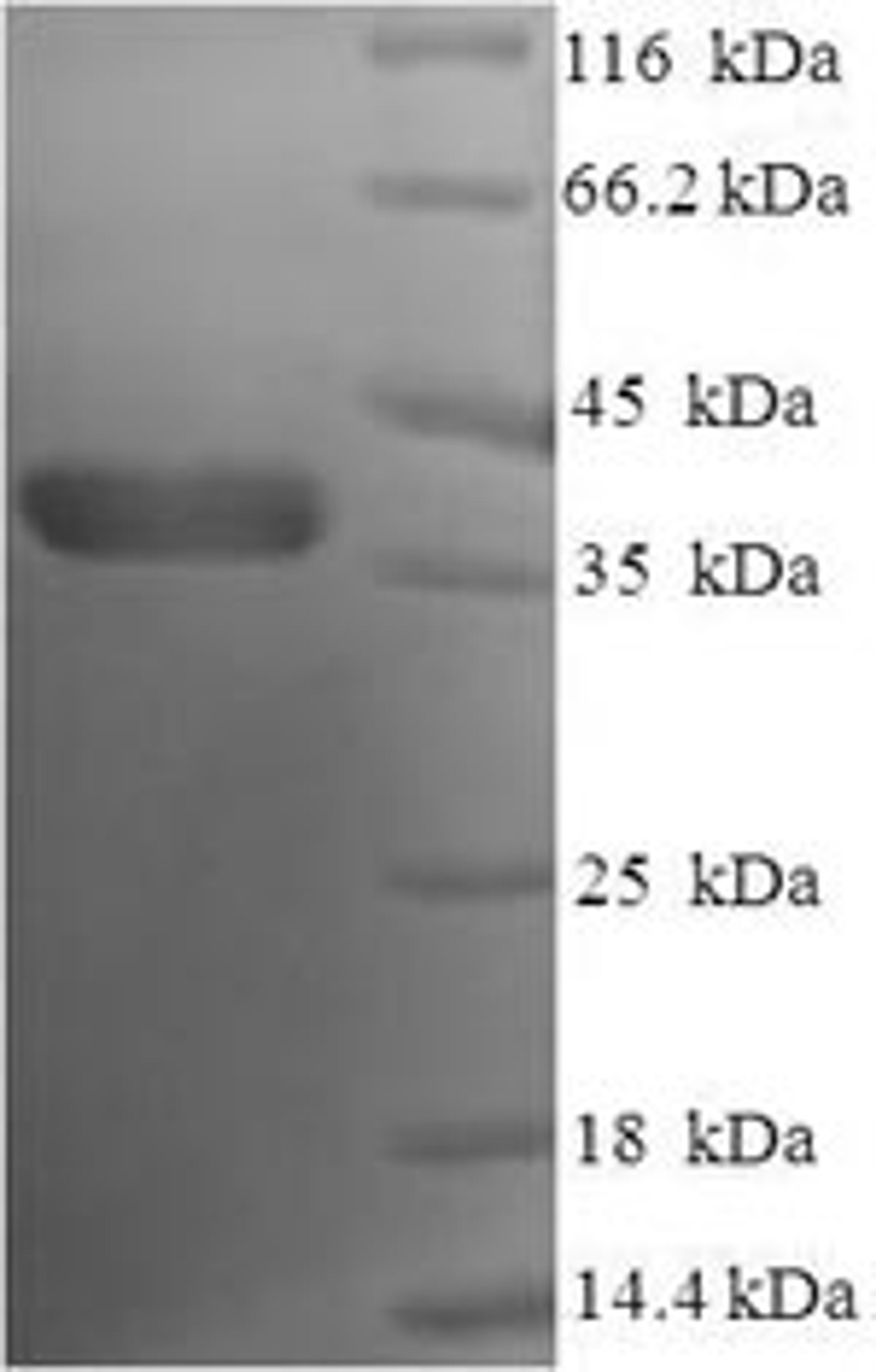 (Tris-Glycine gel) Discontinuous SDS-PAGE (reduced) with 5% enrichment gel and 15% separation gel.