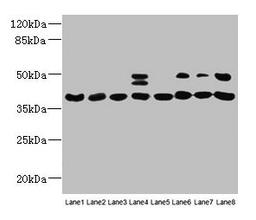 Western blot. All lanes: HIF1AN antibody at 12µg/ml. Lane 1: Mouse heart tissue. Lane 2: Mouse skeletal muscle tissue. Lane 3: K562 whole cell lysate. Lane 4: MCF-7 whole cell lysate. Lane 5: HL60 whole cell lysate. Lane 6: 293T whole cell lysate. Lane 7: Jurkat whole cell lysate. Lane 8: A375 whole cell lysate. Secondary. Goat polyclonal to rabbit IgG at 1/10000 dilution. Predicted band size: 41 kDa. Observed band size: 41, 48 kDa