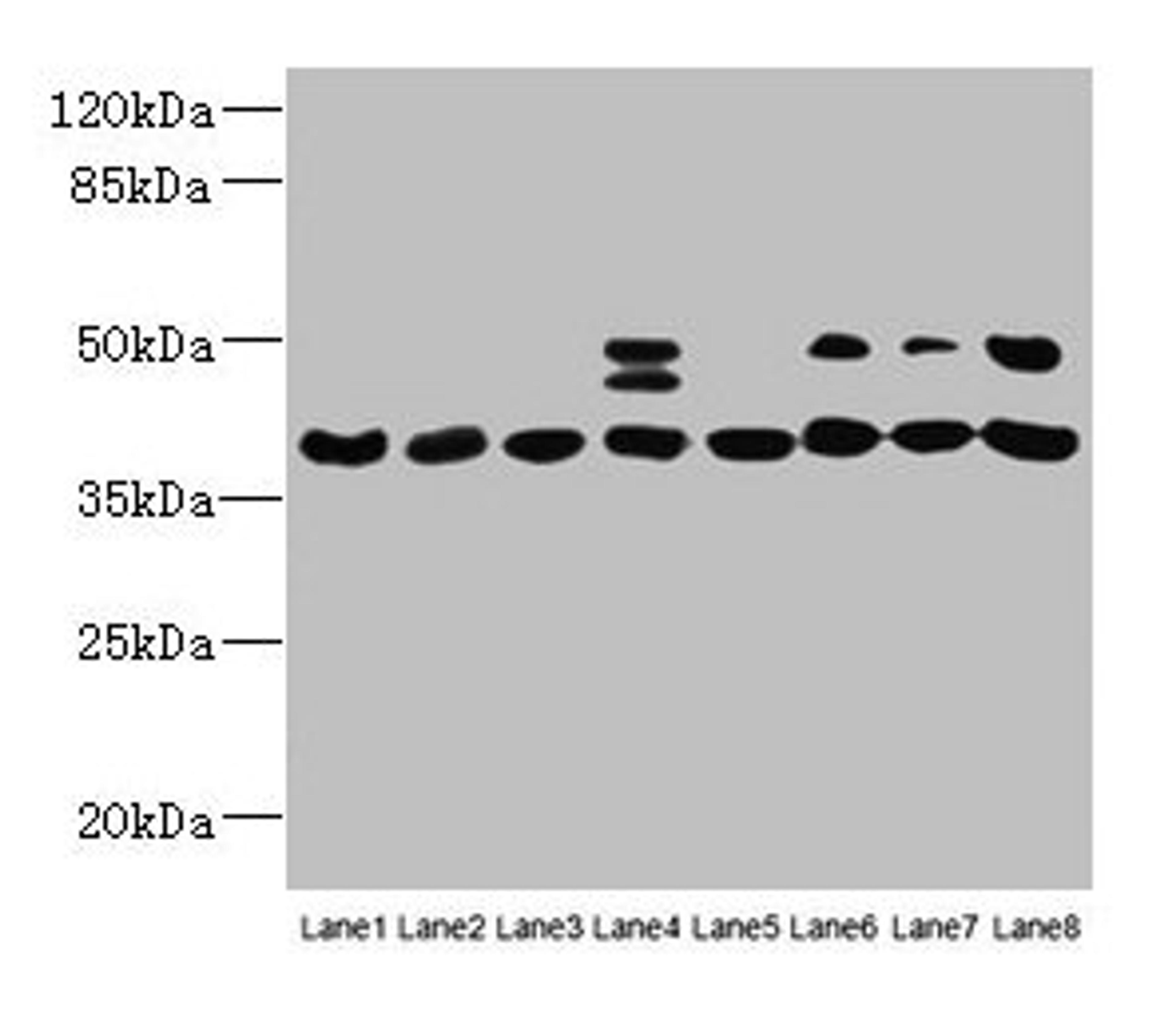Western blot. All lanes: HIF1AN antibody at 12µg/ml. Lane 1: Mouse heart tissue. Lane 2: Mouse skeletal muscle tissue. Lane 3: K562 whole cell lysate. Lane 4: MCF-7 whole cell lysate. Lane 5: HL60 whole cell lysate. Lane 6: 293T whole cell lysate. Lane 7: Jurkat whole cell lysate. Lane 8: A375 whole cell lysate. Secondary. Goat polyclonal to rabbit IgG at 1/10000 dilution. Predicted band size: 41 kDa. Observed band size: 41, 48 kDa
