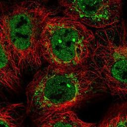 Immunocytochemistry/Immunofluorescence: NDUFB6 Antibody [NBP1-92172] - Staining of human cell line A-431 shows positivity in nucleus but not nucleoli & mitochondria.