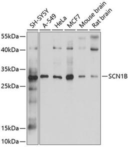 Western blot - SCN1B antibody (A10071)