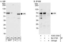 Detection of human VIK by western blot and immunoprecipitation.