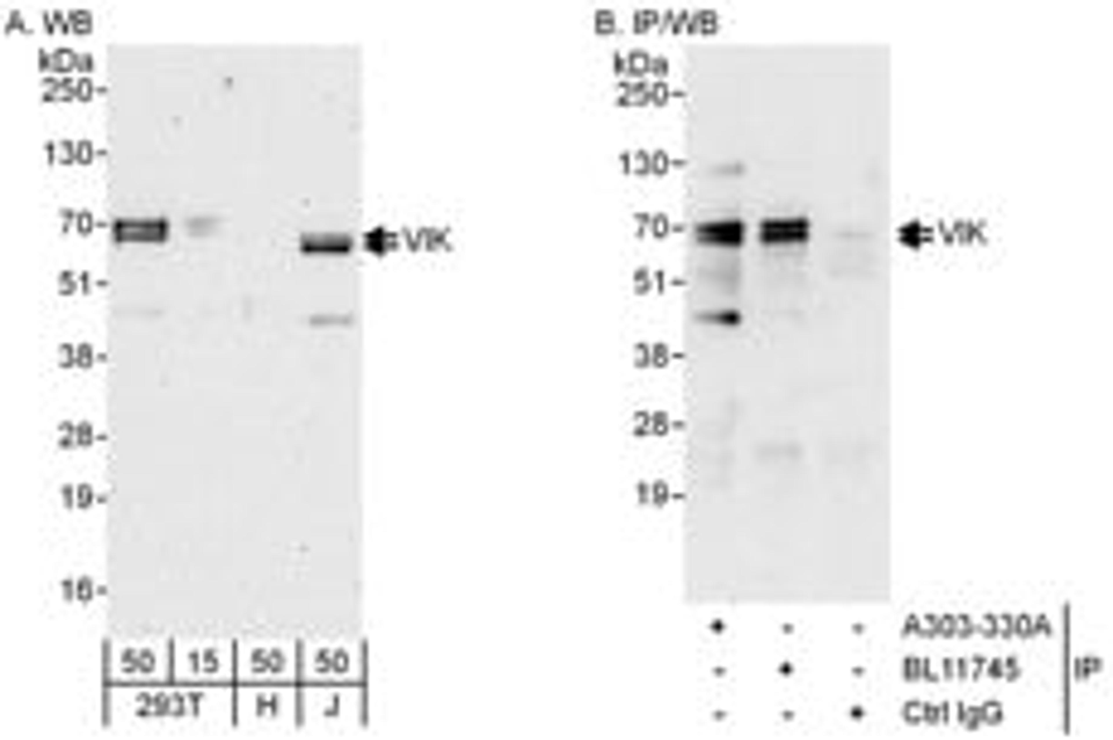 Detection of human VIK by western blot and immunoprecipitation.