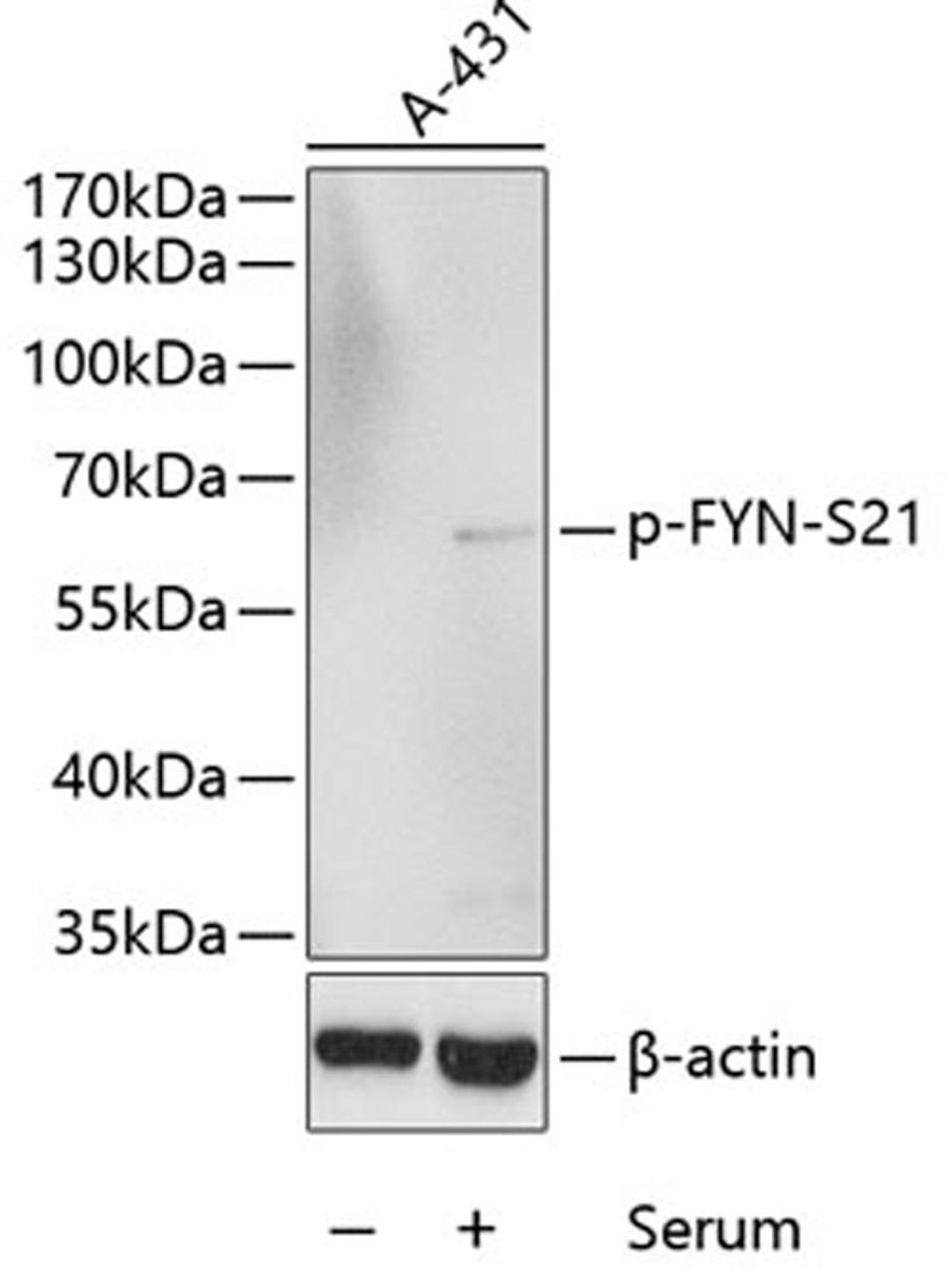 Western blot - Phospho-FYN-S21 antibody (AP0510)