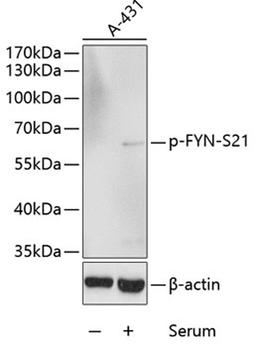 Western blot - Phospho-FYN-S21 antibody (AP0510)