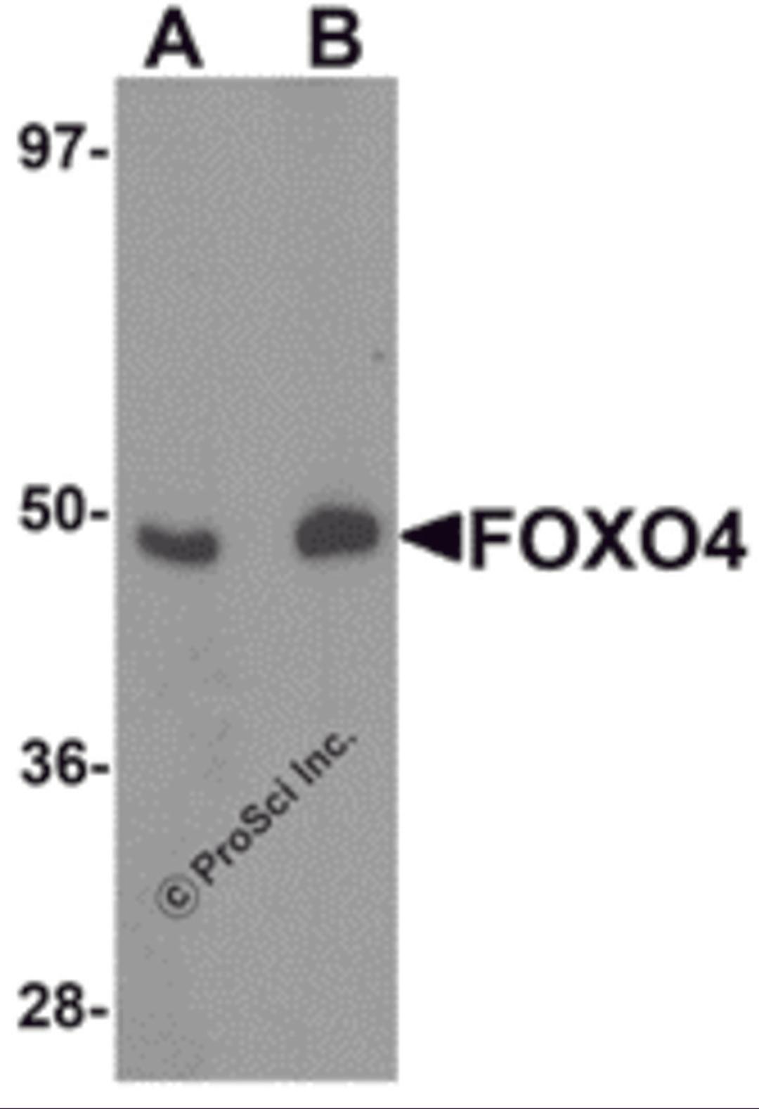 Western blot analysis of FOXO4 in HeLa cell lysate with FOXO4 antibody at (A) 0.5 and (B) 1 &#956;g/mL.