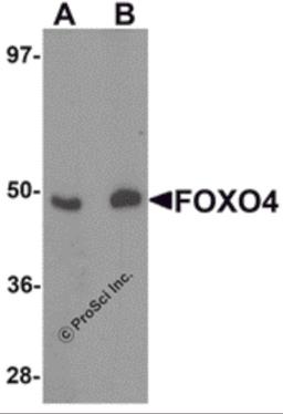Western blot analysis of FOXO4 in HeLa cell lysate with FOXO4 antibody at (A) 0.5 and (B) 1 μg/mL.