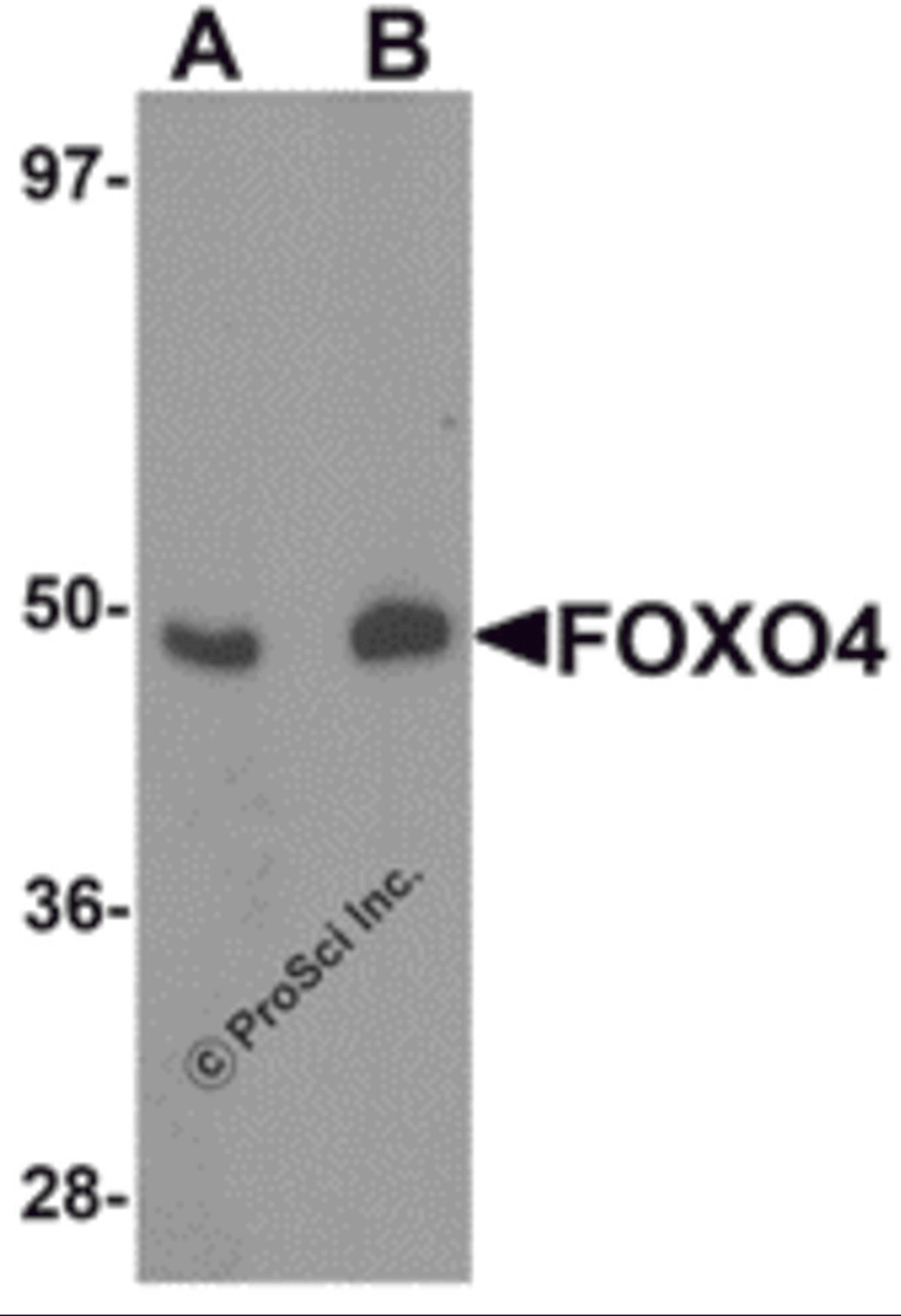 Western blot analysis of FOXO4 in HeLa cell lysate with FOXO4 antibody at (A) 0.5 and (B) 1 μg/mL.