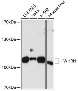 Western blot - WHRN antibody (A10773)