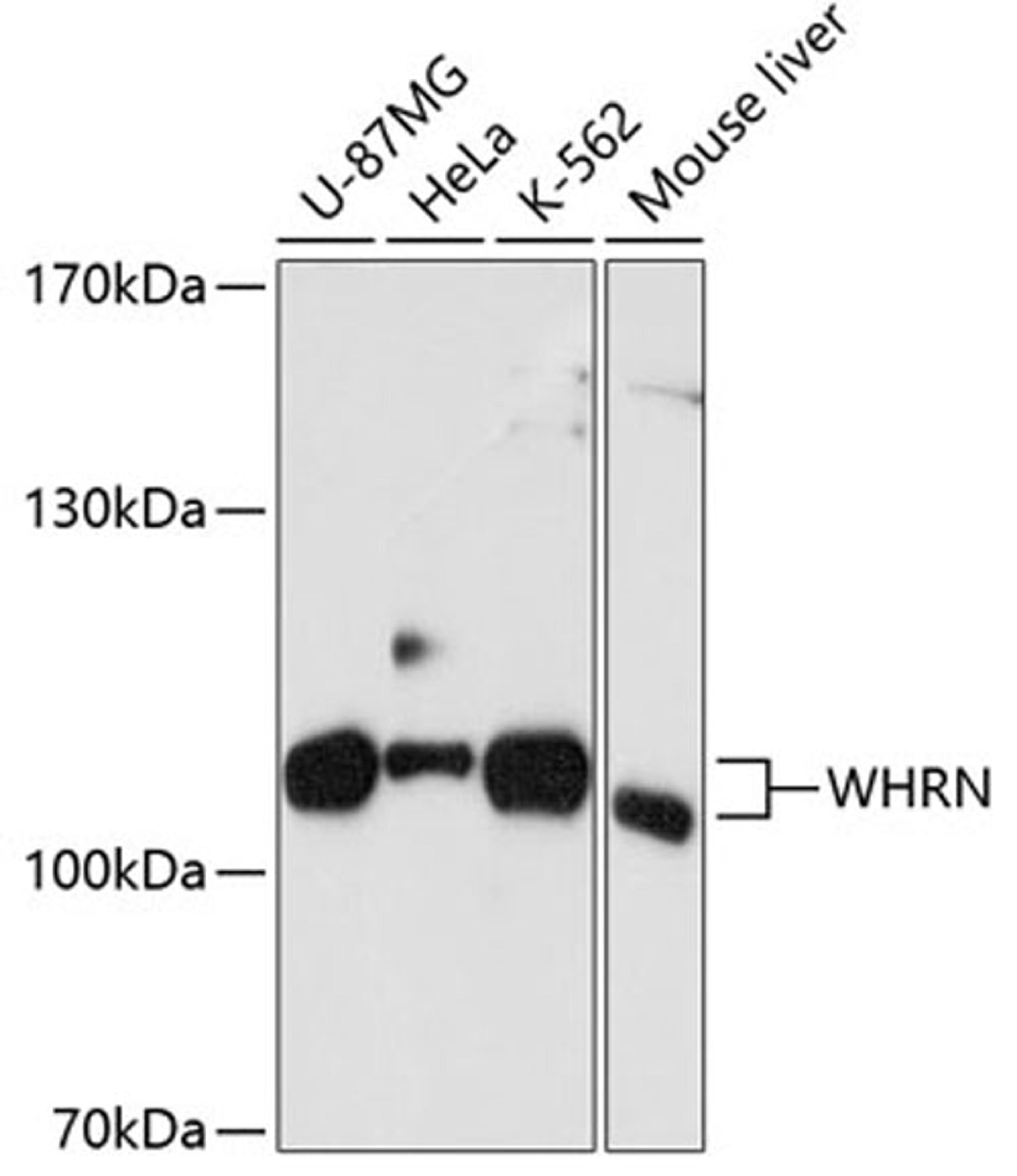 Western blot - WHRN antibody (A10773)