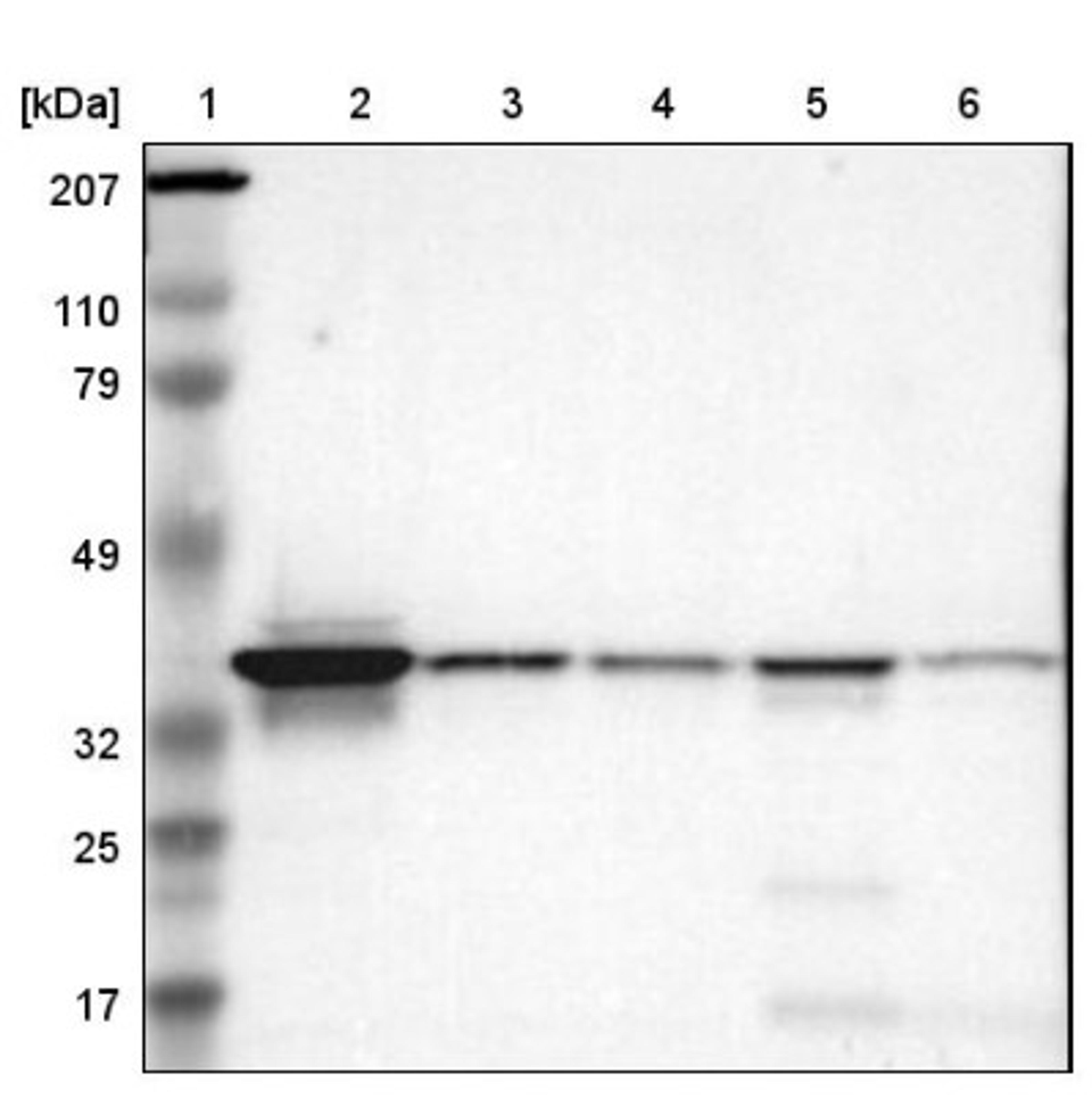 Western Blot: Apolipoprotein L2 Antibody [NBP1-90127] - Lane 1: Marker [kDa] 207, 110, 79, 49, 32, 25, 17<br/>Lane 2: Human cell line RT-4<br/>Lane 3: Human cell line EFO-21<br/>Lane 4: Human cell line A-431<br/>Lane 5: Human liver tissue<br/>Lane 6: Human tonsil tissue