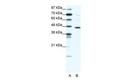 Antibody used in WB on Human cell lines at 1.25 ug/ml.