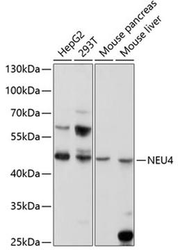 Western blot - NEU4 antibody (A5141)