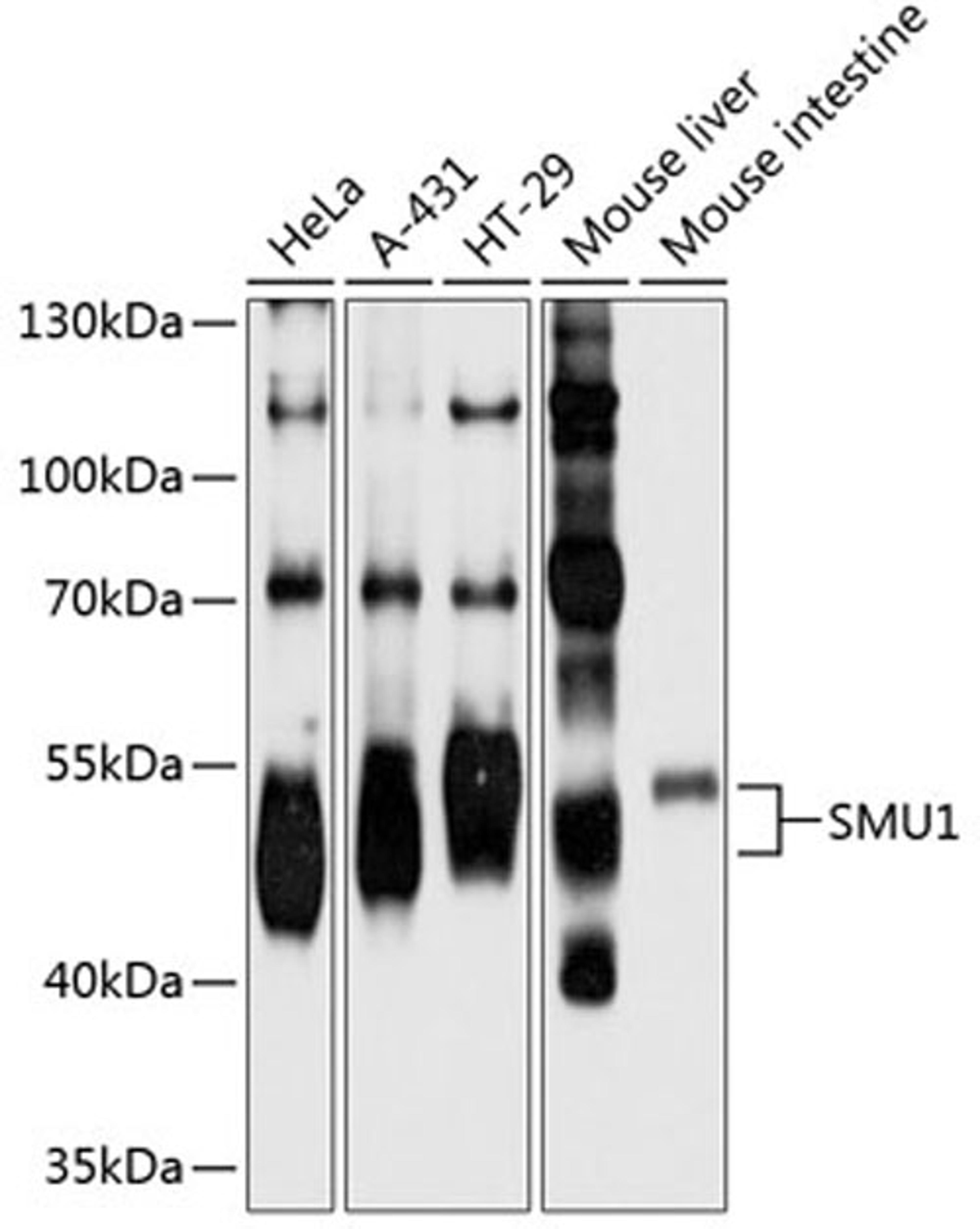 Western blot - SMU1 antibody (A9110)