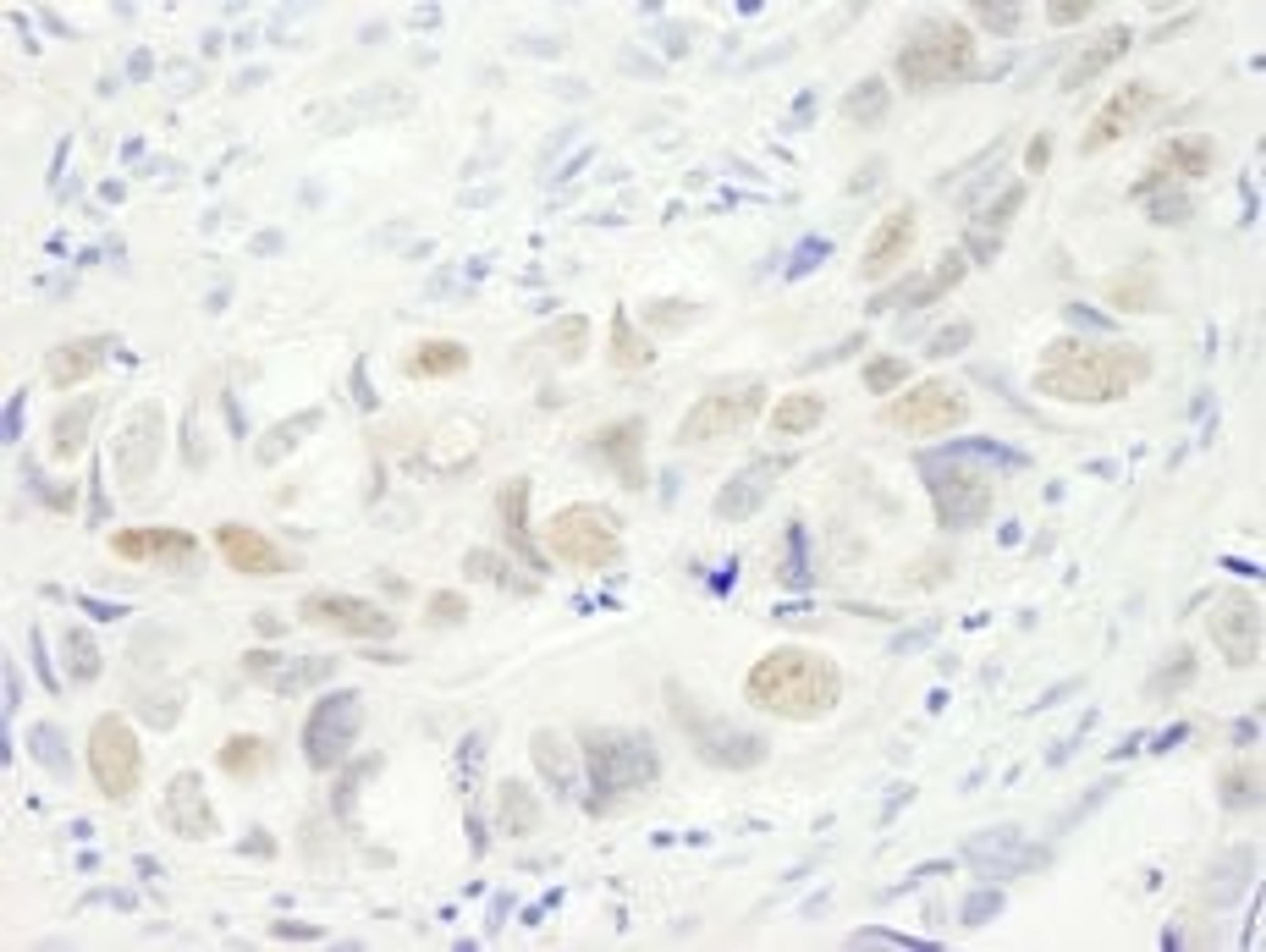 Detection of human Anillin by immunohistochemistry.