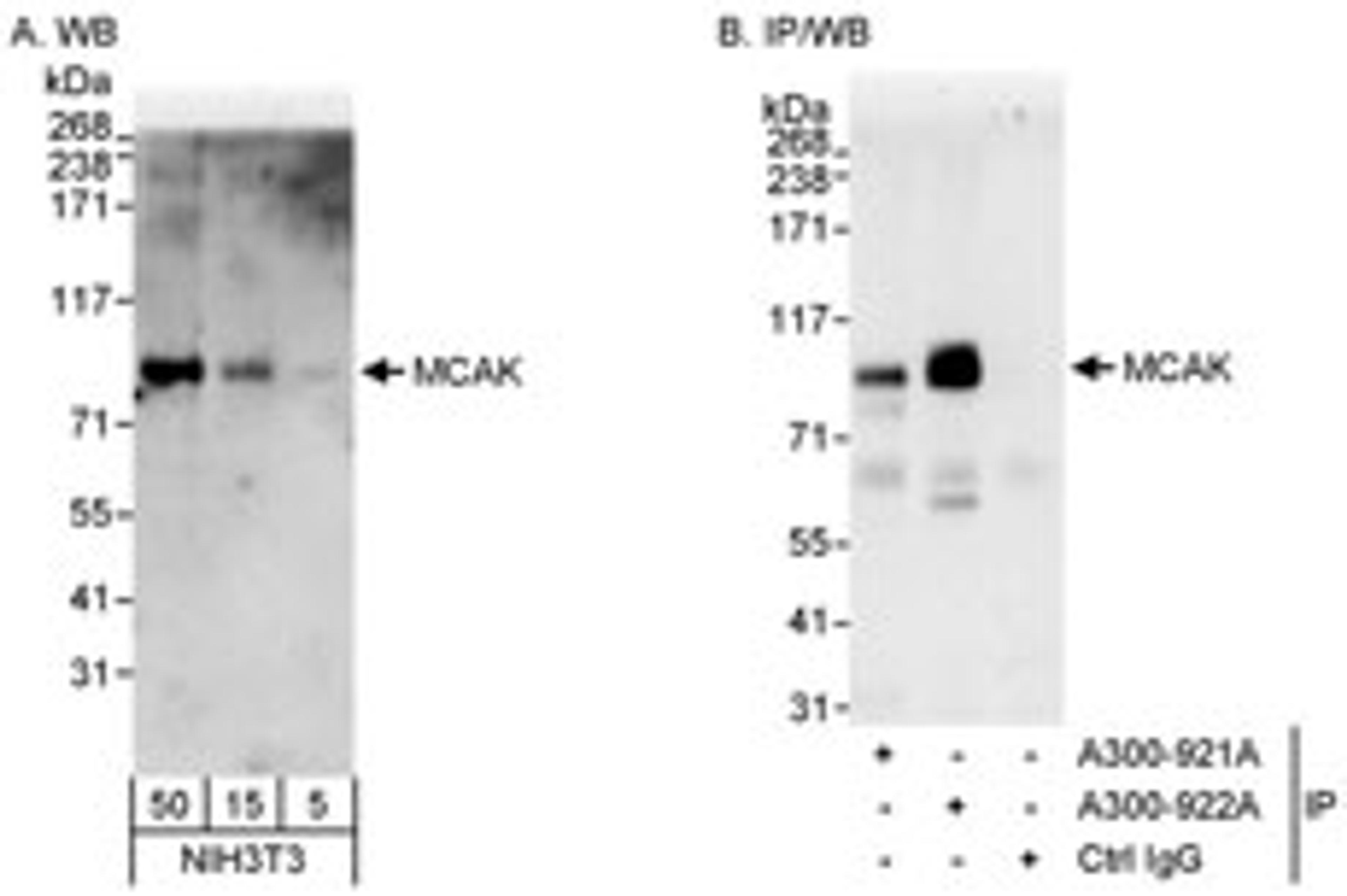 Detection of mouse MCAK by western blot and immunoprecipitation.