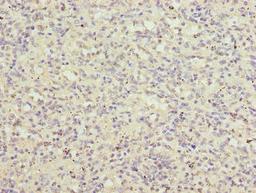 Immunohistochemistry of paraffin-embedded human spleen tissue using CSB-PA857000LA01HU at dilution of 1:100