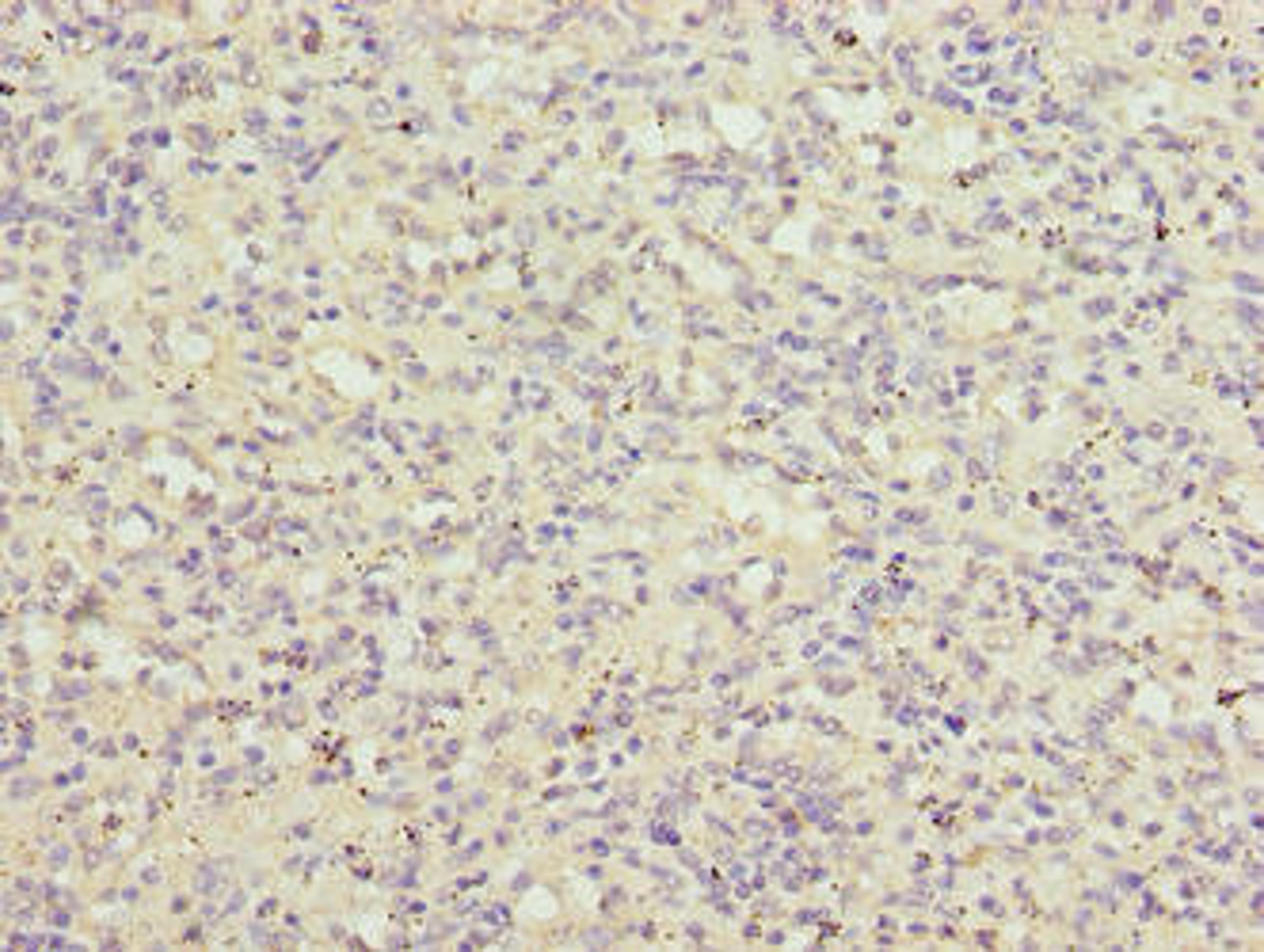 Immunohistochemistry of paraffin-embedded human spleen tissue using CSB-PA857000LA01HU at dilution of 1:100
