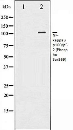 Western blot analysis of MDA-MB-435 whole cell lysates using NF- kappaB p100/p52 (Phospho-Ser869) antibody, The lane on the left is treated with the antigen-specific peptide.