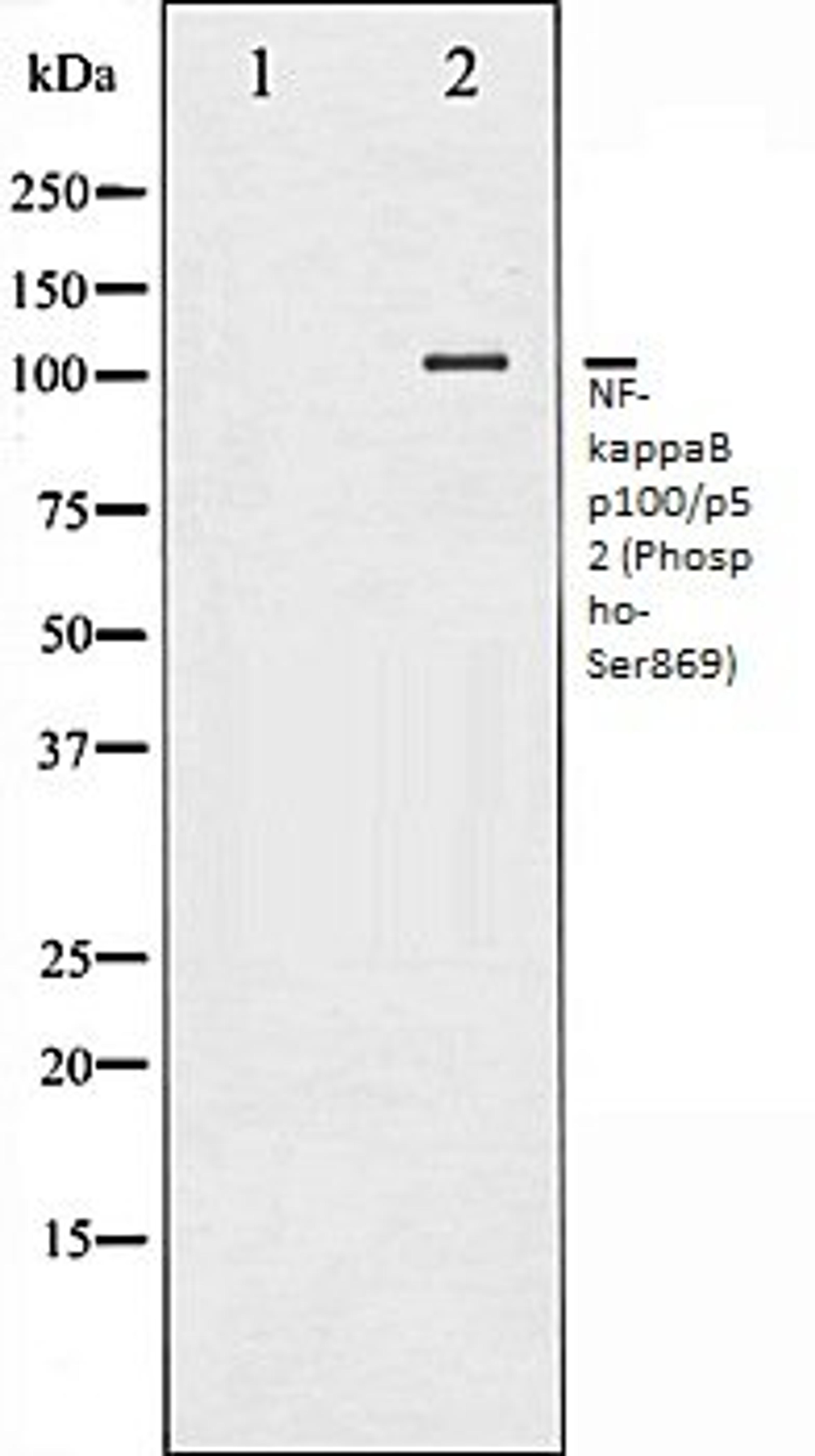 Western blot analysis of MDA-MB-435 whole cell lysates using NF- kappaB p100/p52 (Phospho-Ser869) antibody, The lane on the left is treated with the antigen-specific peptide.