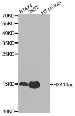 Western blot analysis of extracts of various cell lines using Acetyl-Histone H3-K14 antibody