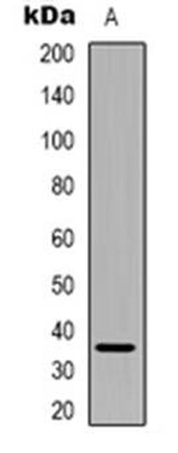 Western blot analysis of PEX2 expression in Hela (Lane 1) whole cell lysates using PEX2 antibody