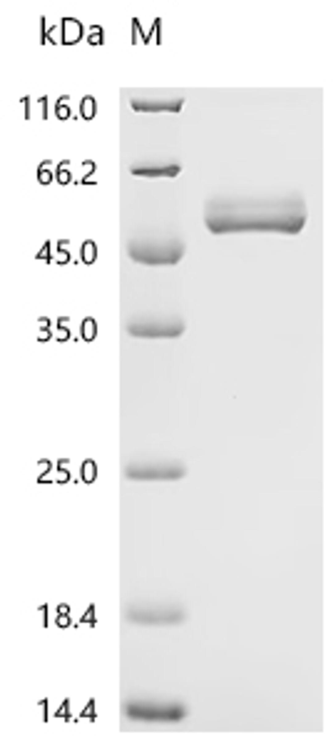 (Tris-Glycine gel) Discontinuous SDS-PAGE (reduced) with 5% enrichment gel and 15% separation gel.