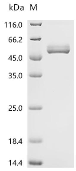 (Tris-Glycine gel) Discontinuous SDS-PAGE (reduced) with 5% enrichment gel and 15% separation gel.
