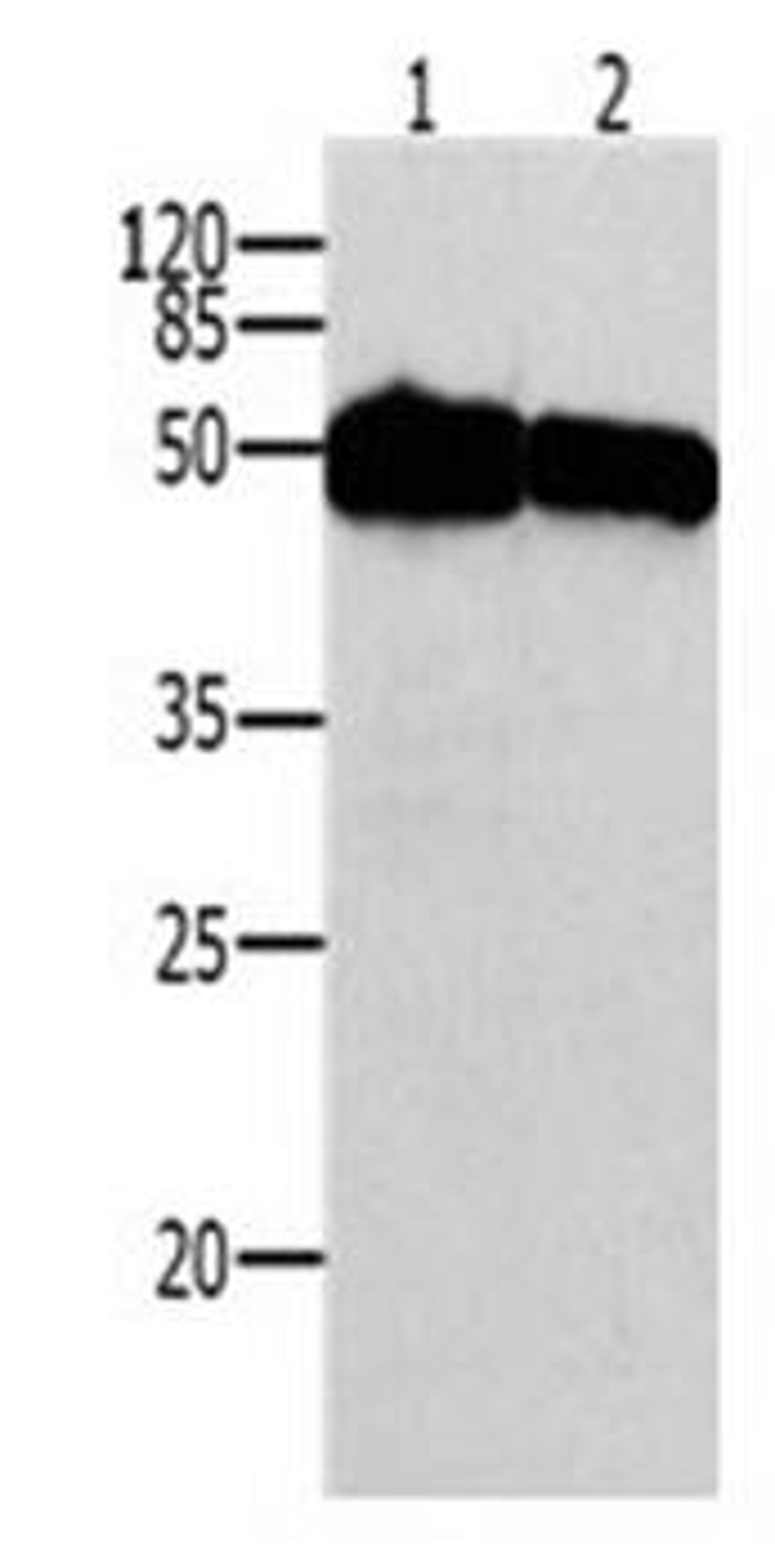 Western blot analysis of Human breast, Human colon cancer tissue lysate (40ug lysate) at:1:200 dilution using TP53 antibody