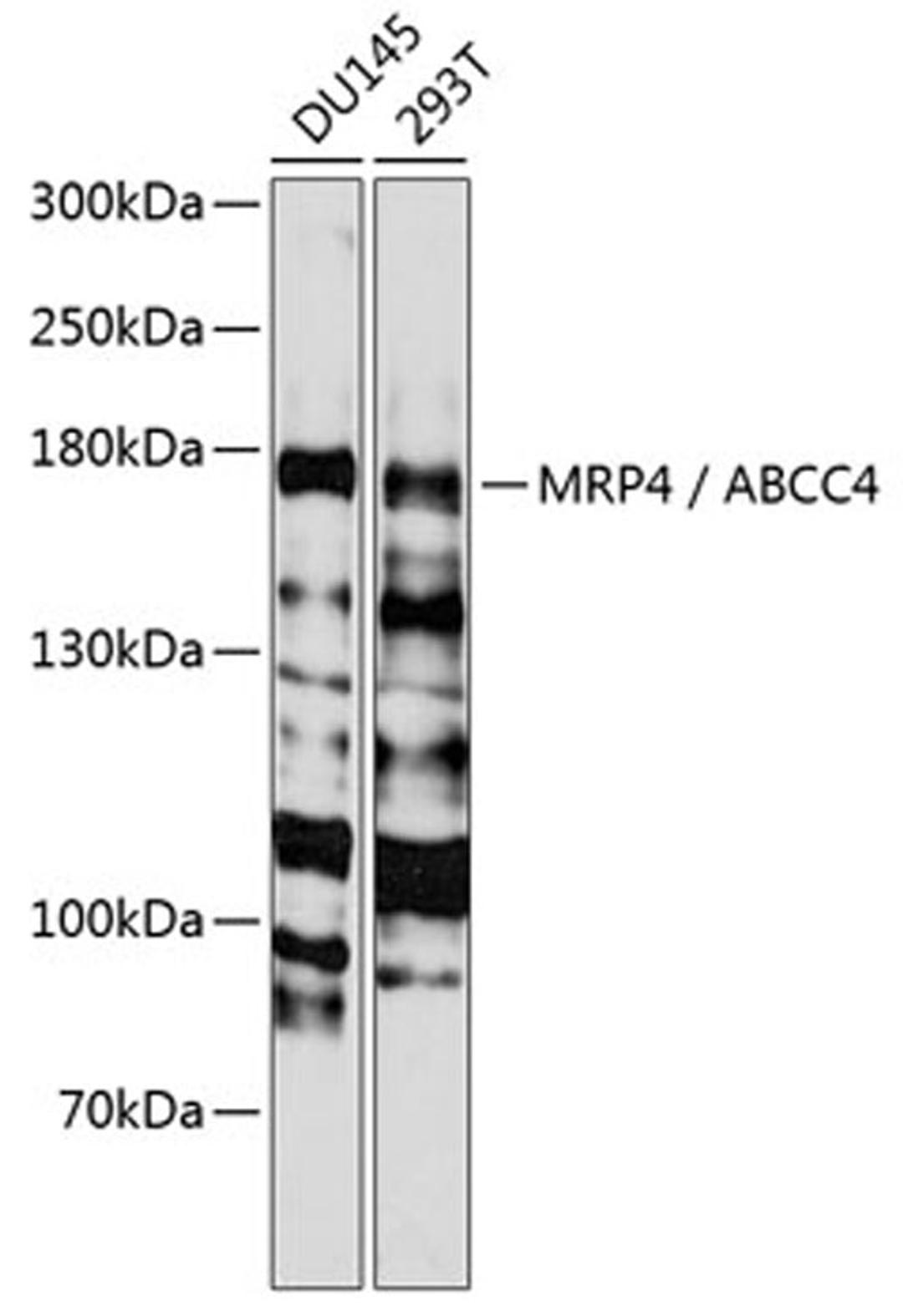 Western blot - MRP4 / ABCC4 antibody (A2198)