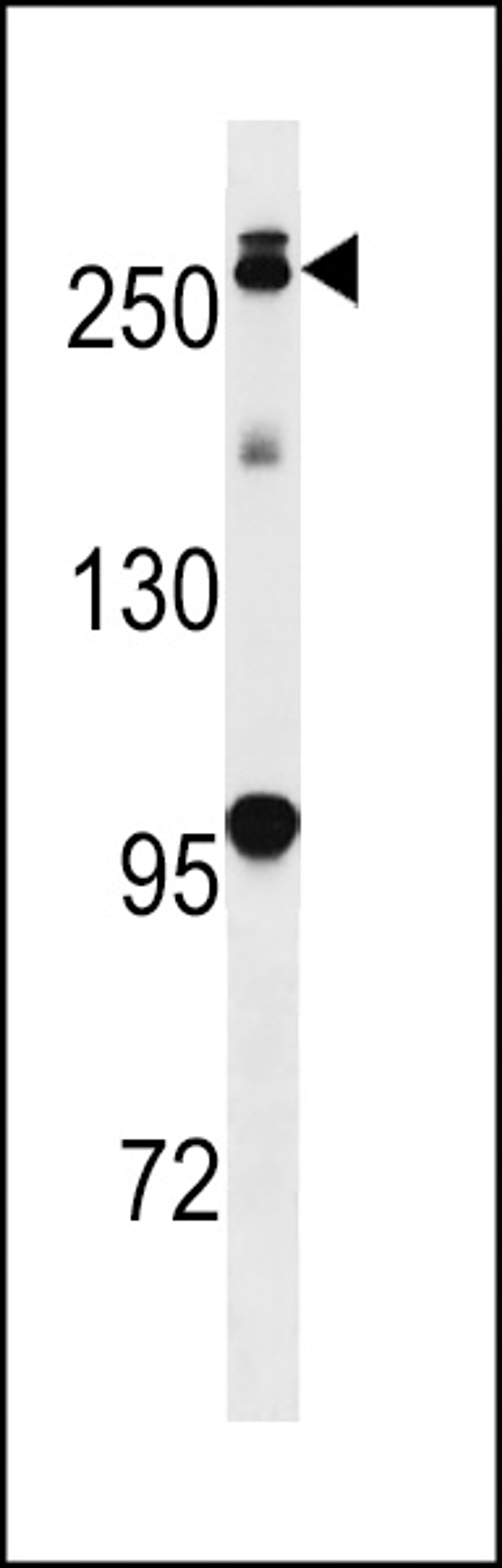 Western blot analysis in mouse lung tissue lysates (35ug/lane).This demonstrates the Park8 (LRRK2) antibody detected the Park8 (LRRK2) protein (arrow).