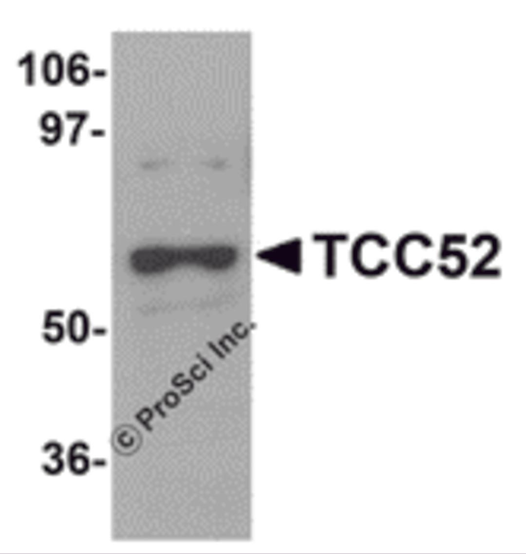Western blot analysis of TCC52 in 293 cell lysate with TCC52 antibody at 1 μg/mL.