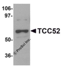 Western blot analysis of TCC52 in 293 cell lysate with TCC52 antibody at 1 μg/mL.