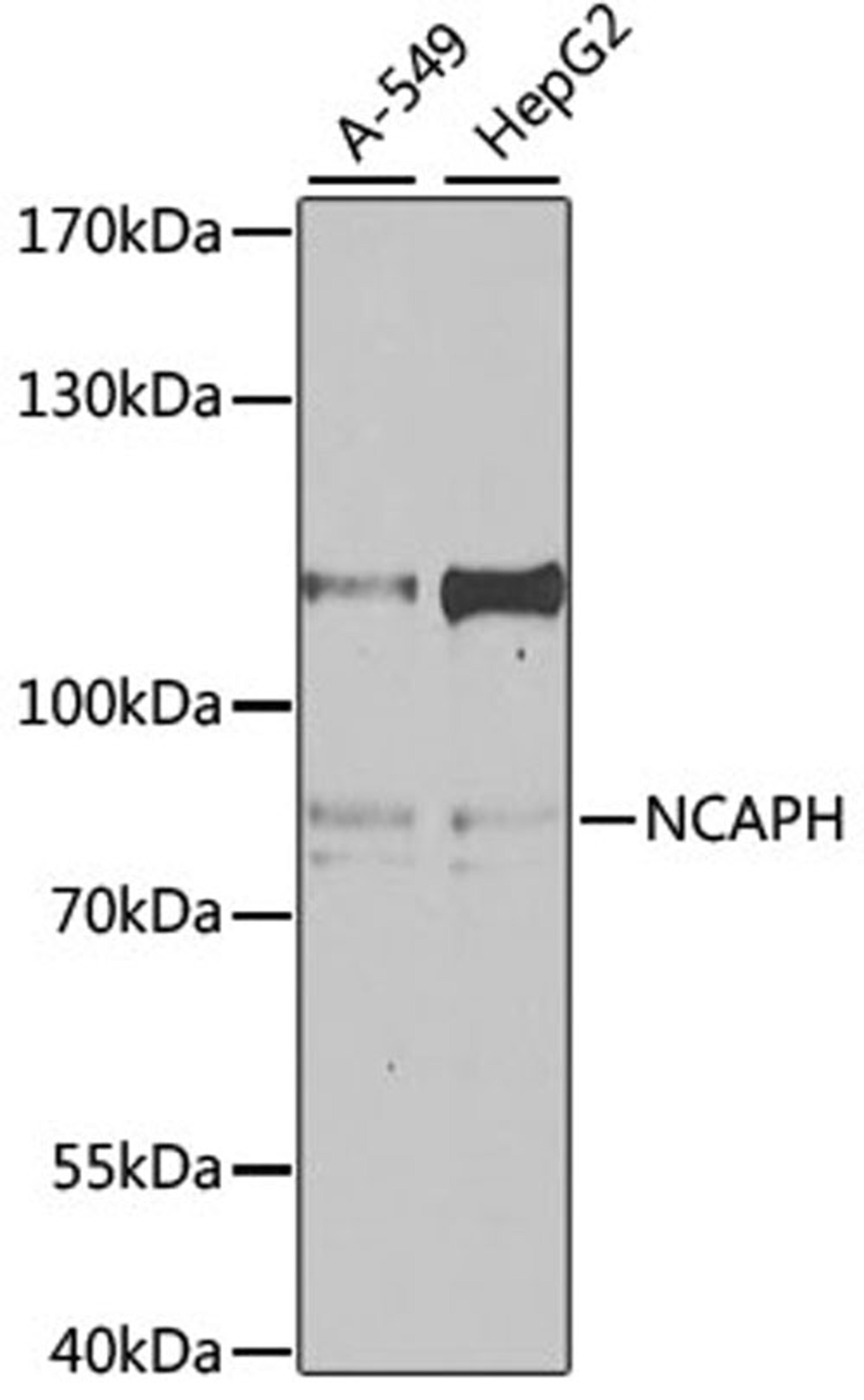 Western blot - NCAPH antibody (A4548)