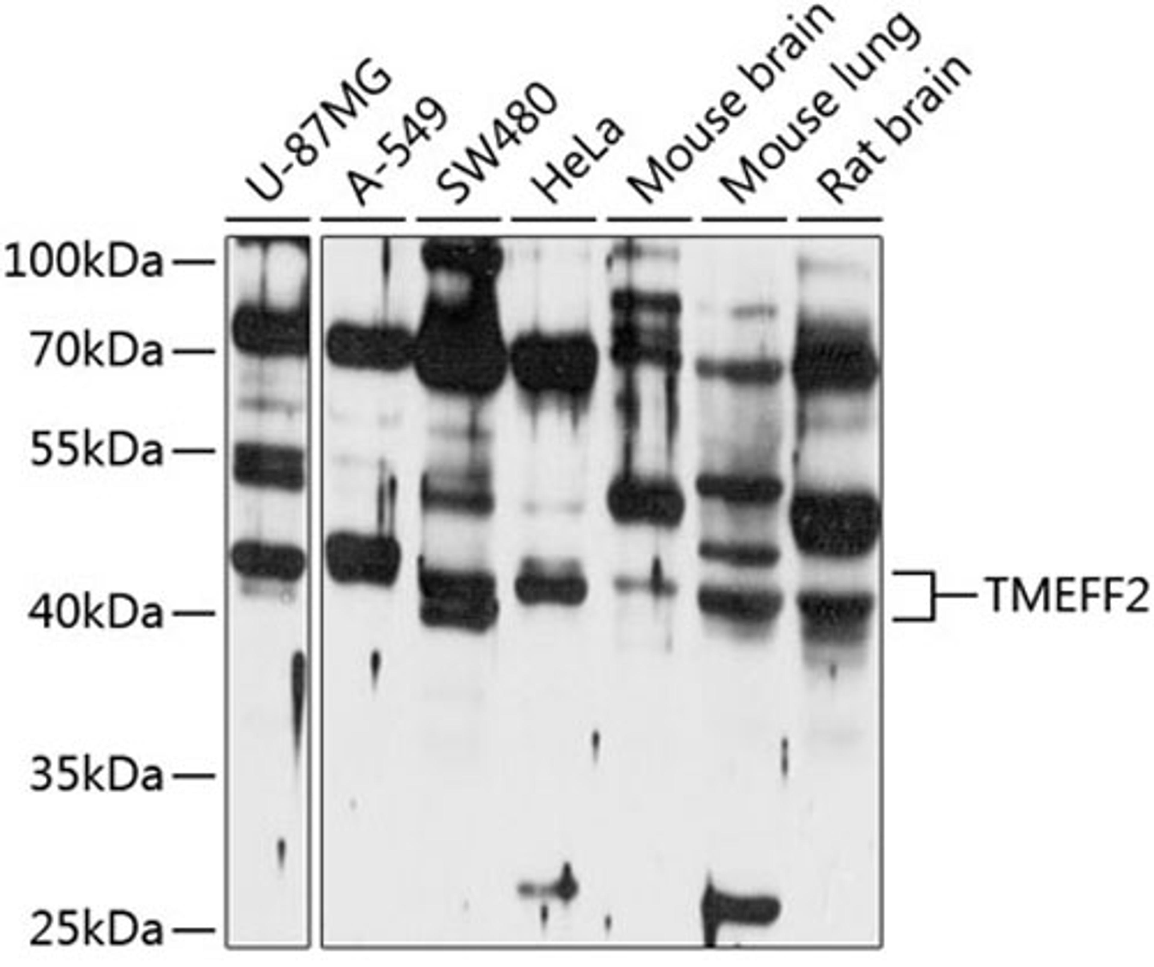 Western blot - TMEFF2 antibody (A10464)