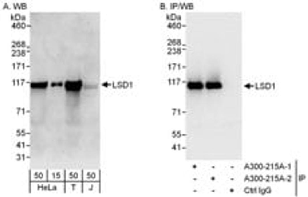 Detection of human LSD1 by western blot and immunoprecipitation.