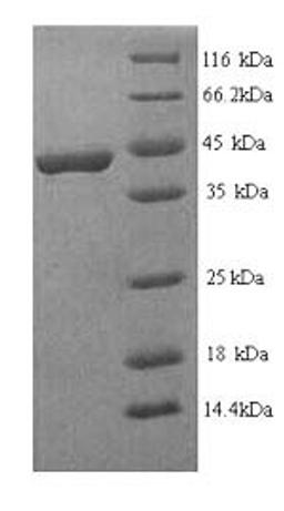 (Tris-Glycine gel) Discontinuous SDS-PAGE (reduced) with 5% enrichment gel and 15% separation gel.